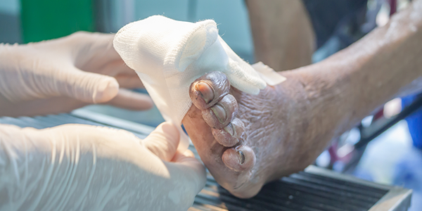 Wound Care Services